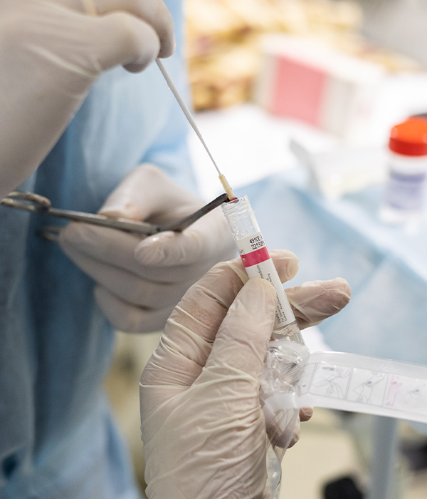 Close-up of a biopsy endoscopic forceps with a piece of tissue.